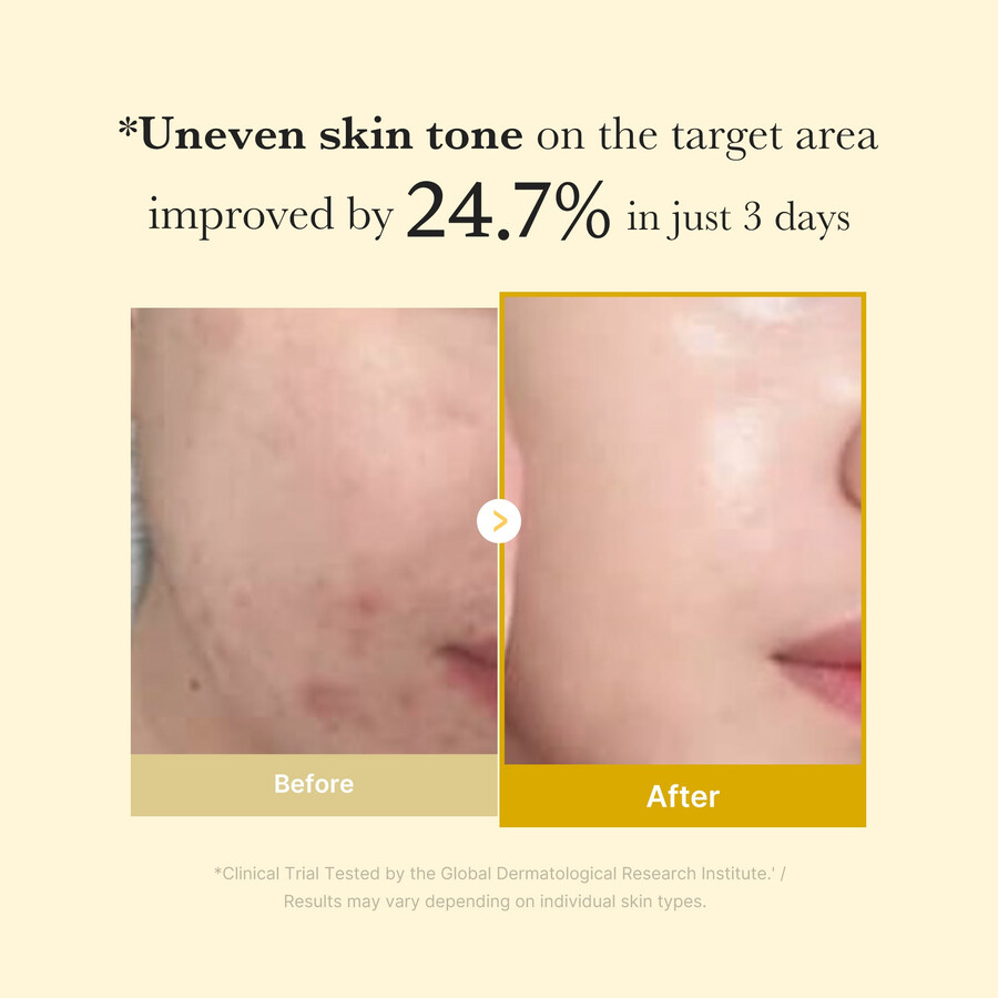 medicube kojic acid kurkuma nachtmasker