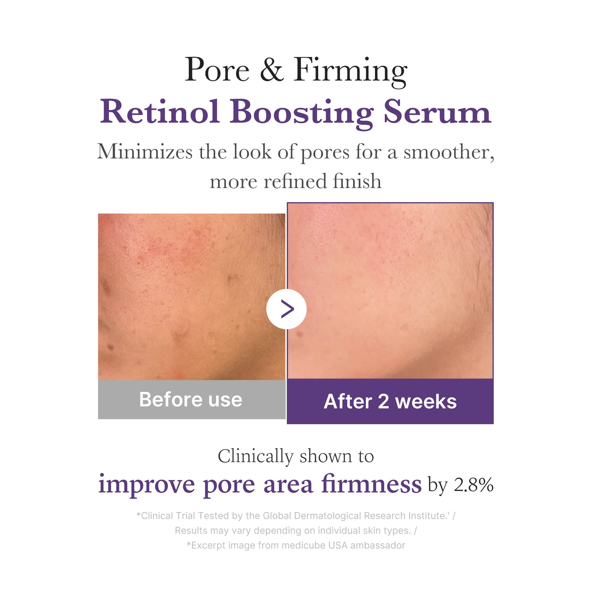 retinol nmn-boostend serum