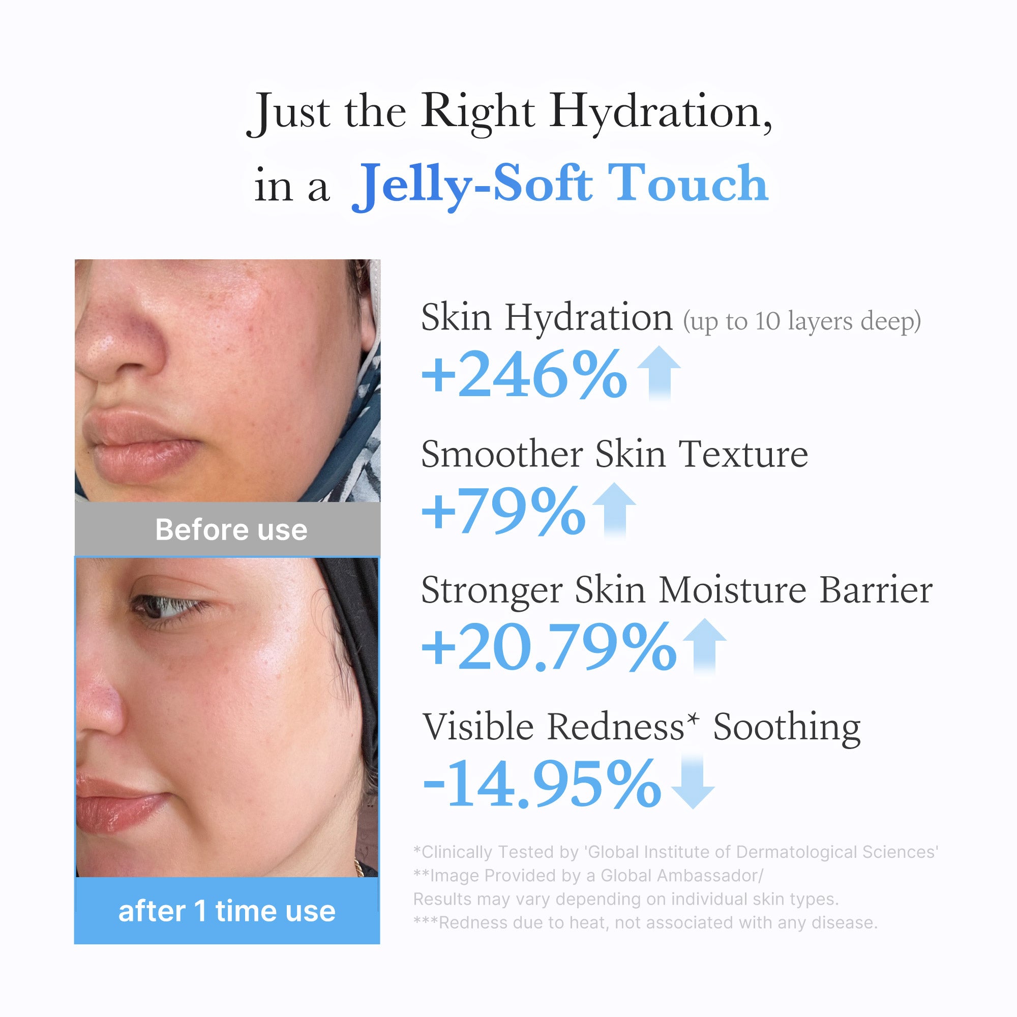 hyaluronzuur ceramide hydraterende jelly cream