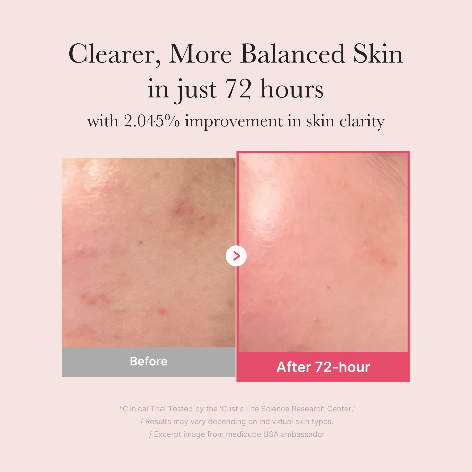 txa niacinamide-serum