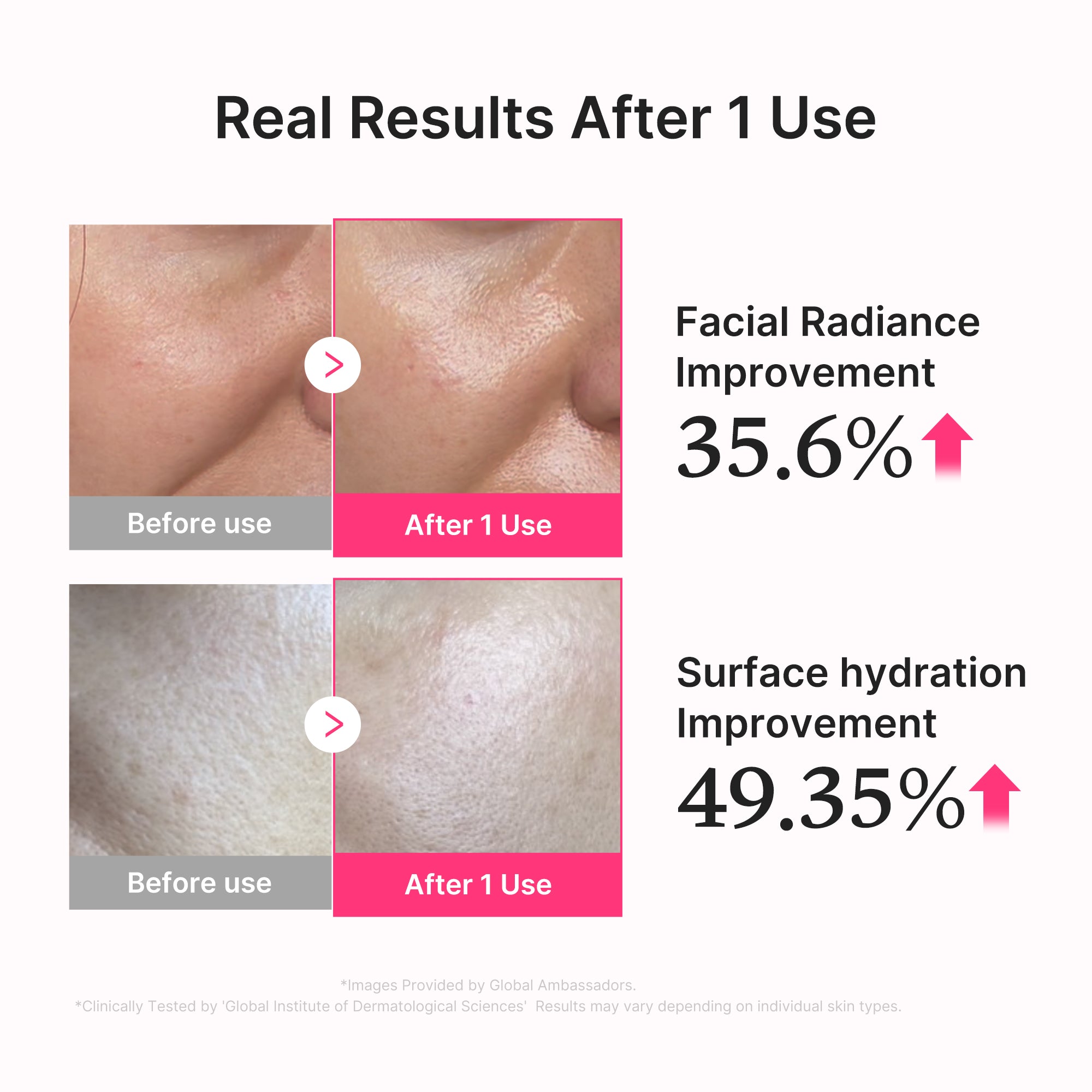 pdrn roze collageen glow jelly serum