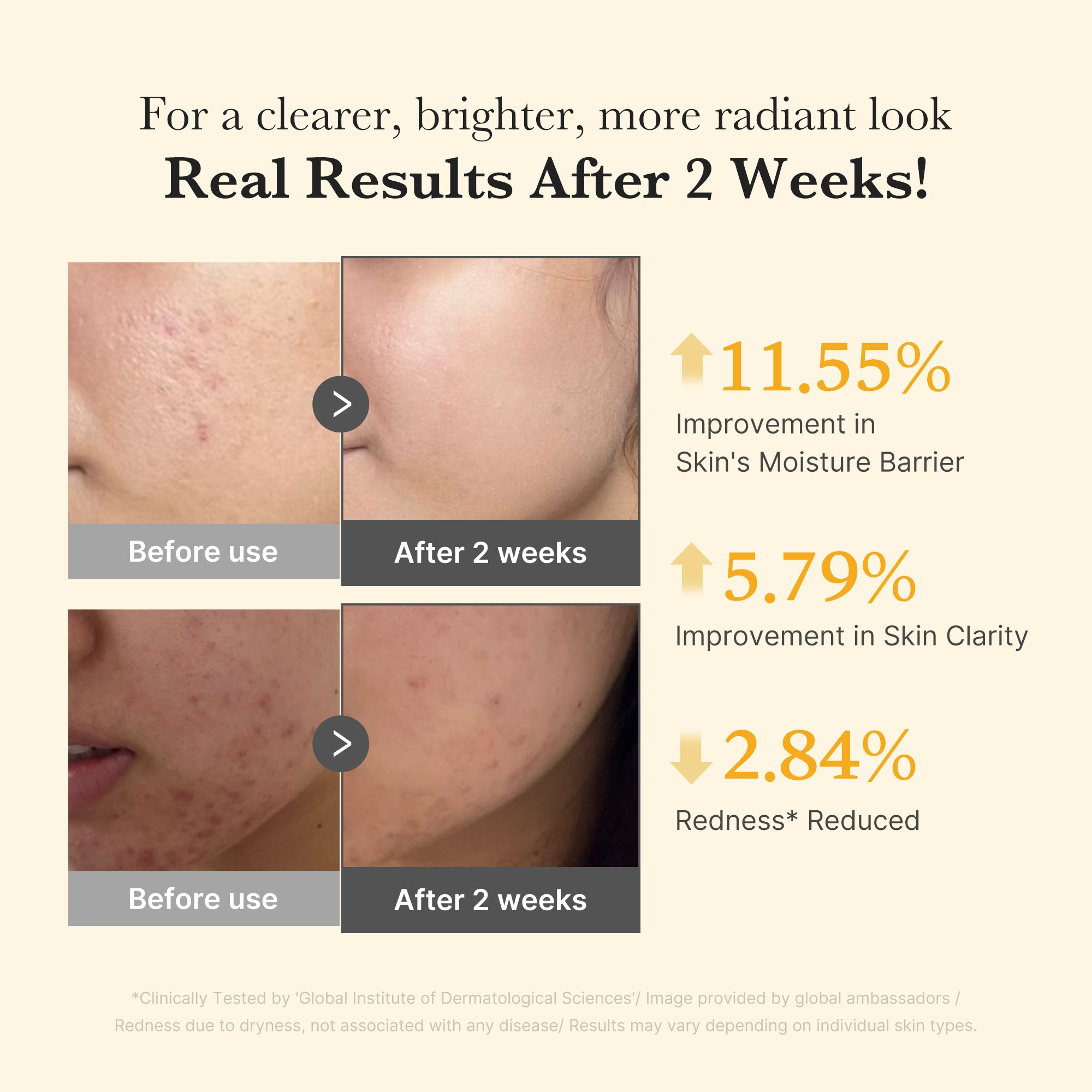 kojiczuur kurkuma capsule serum