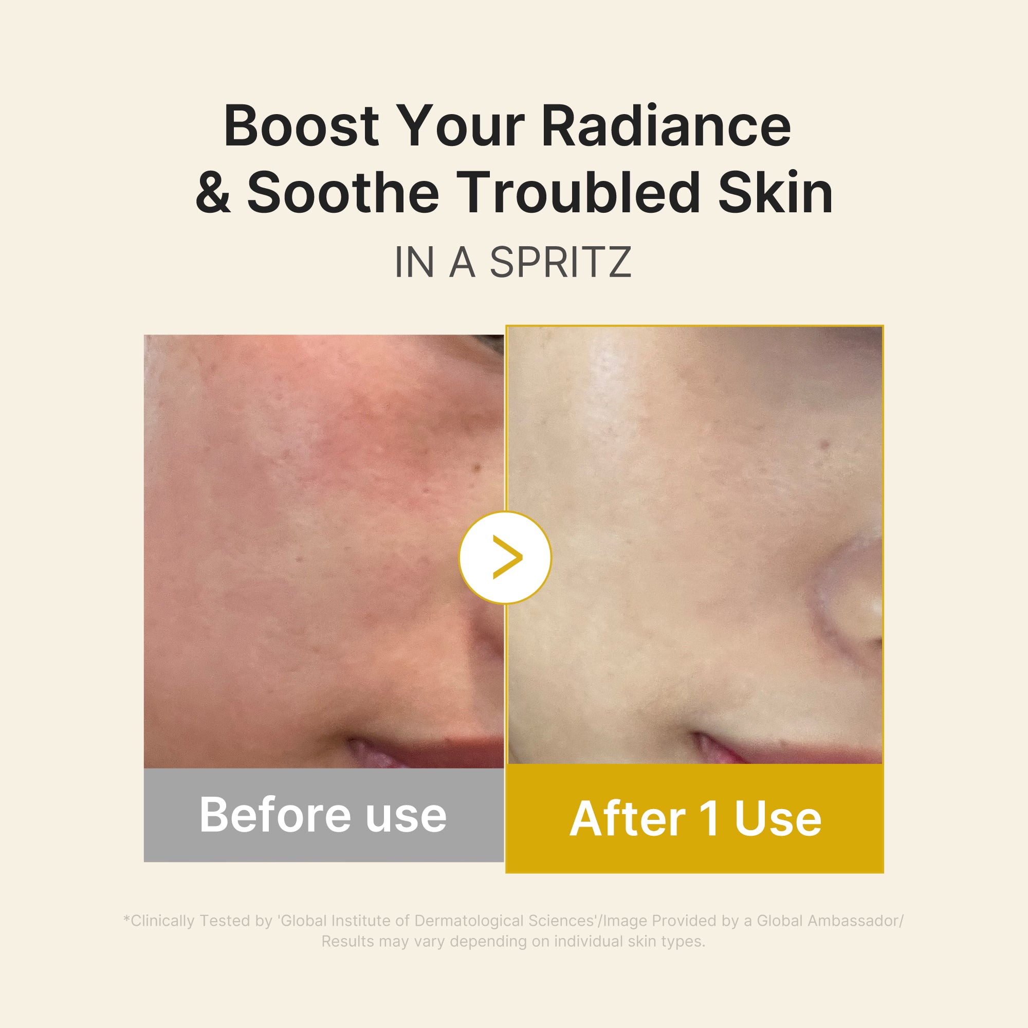 kojiczuur kurkuma vitamine goud jelly mist serum