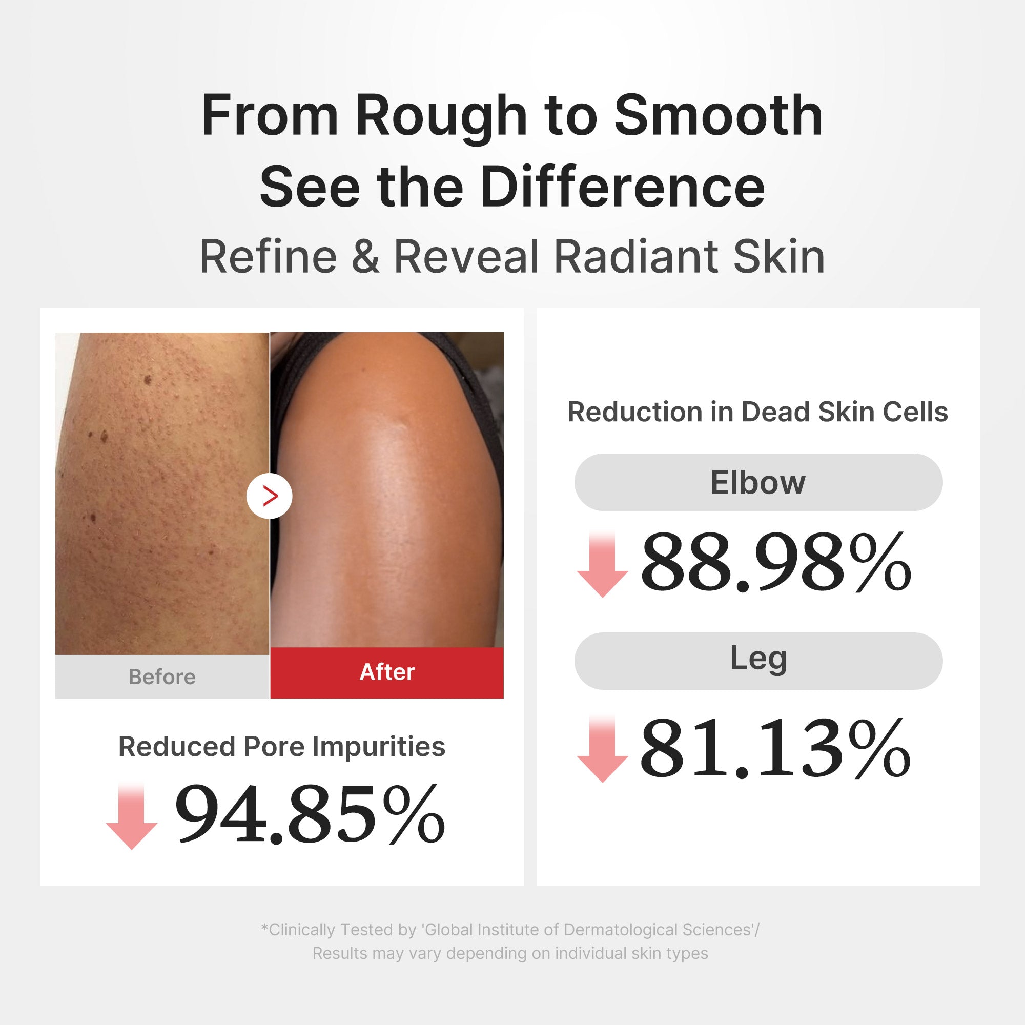 hypochloorzuur rijst body peel shot